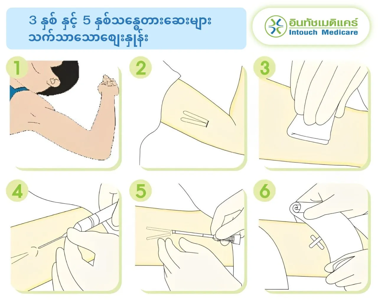 3 နှစ် နှင့် 5 နှစ်သန္ဓေတားဆေးများ သက်သာသောစျေးနှုန်း 3 နှစ် နှင့် 5 နှစ်သန္ဓေတားဆေးများ သက်သာသောစျေးနှုန်း