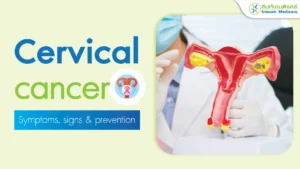 Cervical cancer: symptoms, prevention, and treatment