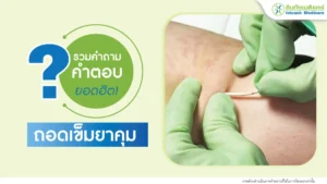 คำถามถอดเข็มยาคุมที่พบบ่อย