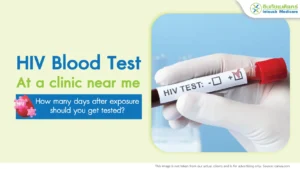 HIV Blood Test