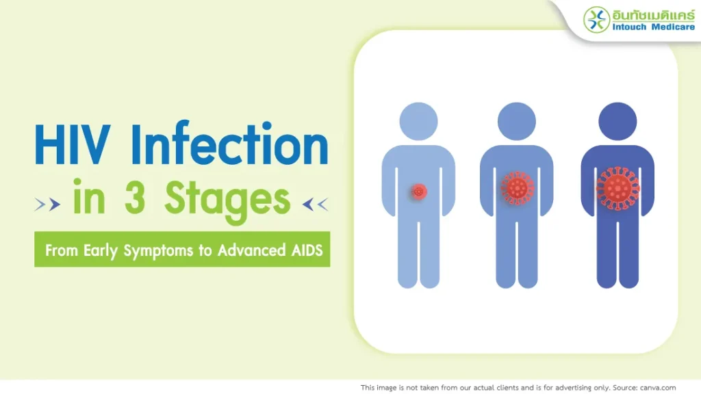 HIV Infection in 3 Stages: From Early Symptoms to Advanced AIDS