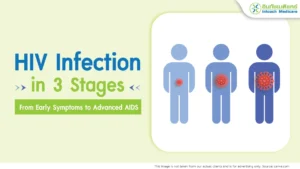 HIV Infection in 3 Stages: From Early Symptoms to Advanced AIDS