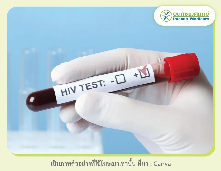 บริการตรวจ hiv