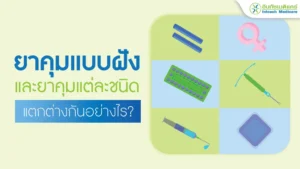 ยาคุมแบบฝังและยาคุมแต่ละชนิดแตกต่างกันอย่างไร