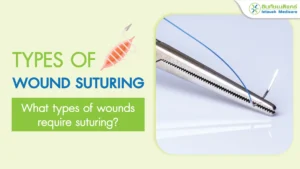 How many types of wound suturing are there? What types of wounds require suturing?