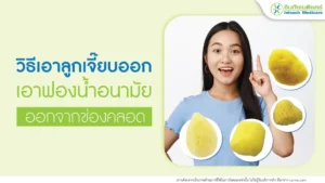 เอาลูกเจี๊ยบออกจากช่องคลอด