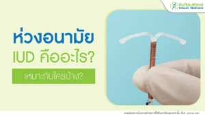 ใส่ห่วงคุมกำเนิด ห่วงอนามัย เหมาะกับใครบ้าง