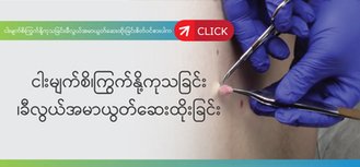 Keloid-injection-cut-off-skin-polyps-tickle-warts-click ကြက်နို့/ငါးမျက်စိကုသခြင်း/ခီလွယ်(အမာယွတ်)ဆေးထိုးခြင်း