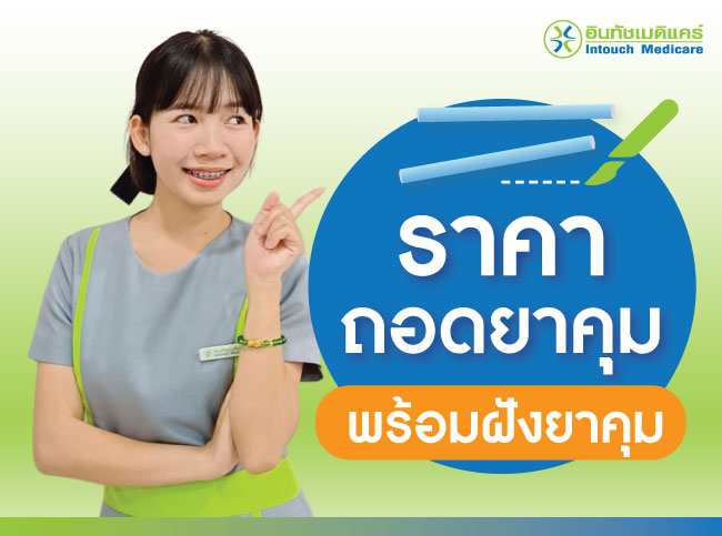 ราคา ถอดยาคุม พร้อมฝังยาคุม ราคา ถอดยาคุม พร้อมฝังยาคุม
