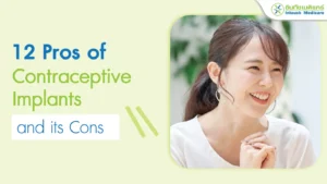 12 Pros of Contraceptive Implants