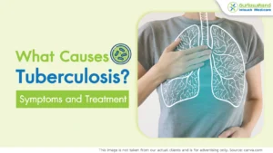 What Causes Tuberculosis Symptoms and Treatment