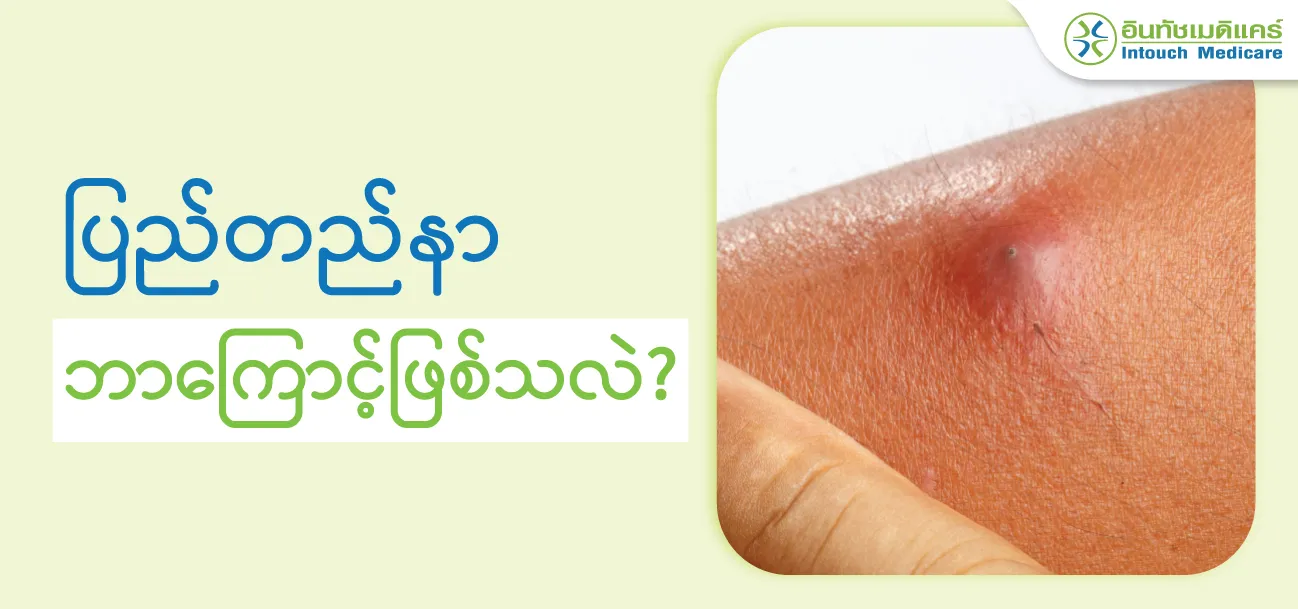 ပြည်တည်နာ ဘာကြောင့်ဖြစ်သလဲ? ပြည်တည်နာပြည်ဖောက်ထုတ်ရင်နာပါသလား ...