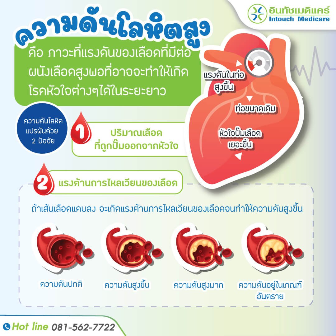 ความดันโลหิตสูง ความดันโลหิตสูง