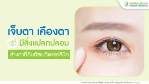 เจ็บตา เคืองตา ล้างตาที่คลินิก
