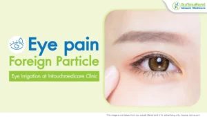 Eye Irrigation at the Clinic