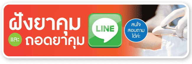 ฝังยาคุมและถอดยาคุม line สอบถาม ฝังยาคุมและถอดยาคุม line สอบถาม