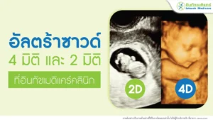 อัลตร้าซาวด์ 4 มิติ อัลตร้าซาวด์ 2 มิติ