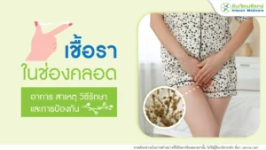เชื้อราในช่องคลอด อาการ สาเหตุ วิธีรักษา และการป้องกัน