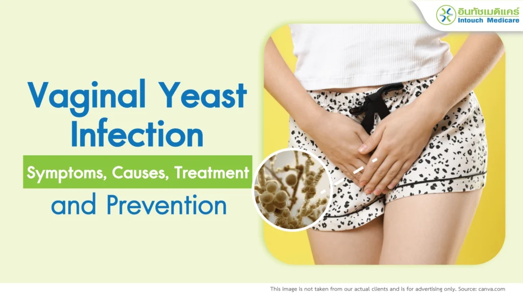 vaginal-candidiasis-symptoms-cause-treatment-prevention