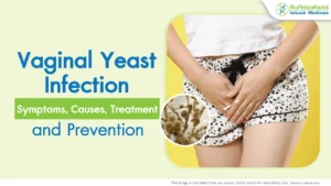 vaginal-candidiasis-symptoms-cause-treatment-prevention