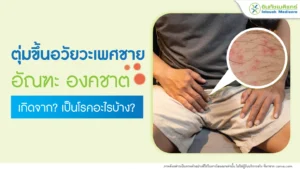 ตุ่มขึ้นที่อัณฑะ ตุ่มที่องคชาต เกิดจากอะไร เป็นโรคอะไรบ้าง?