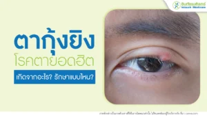 ตากุ้งยิง