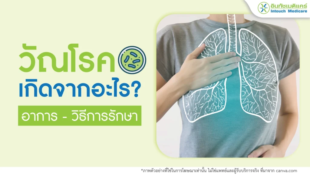 วัณโรคเกิดจากอะไร อาการและวิธีการรักษา