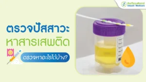 ตรวจปัสสาวะหาสารเสพติด ตรวจหาอะไรได้บ้าง