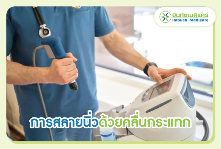 การสลายนิ่วด้วยคลื่นกระแทก