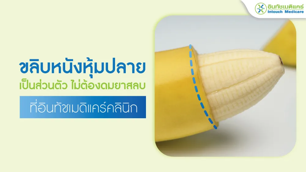 ขลิบหนังหุ้มปลาย
