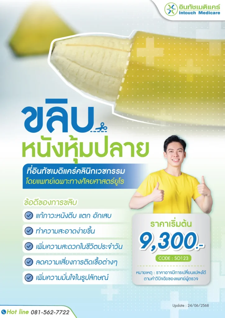 ราคาขลิบหนังหุ้มปลาย