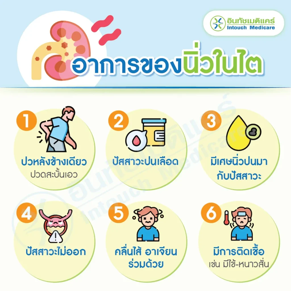 อาการของนิ่วในไต