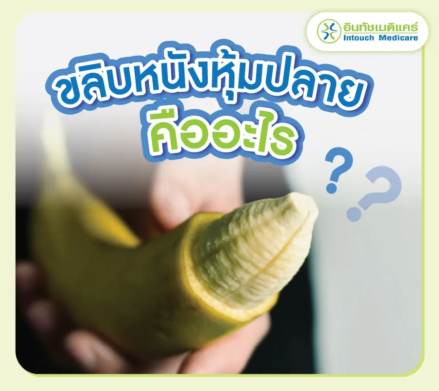 การขลิบหนังหุ้มปลายคืออะไร