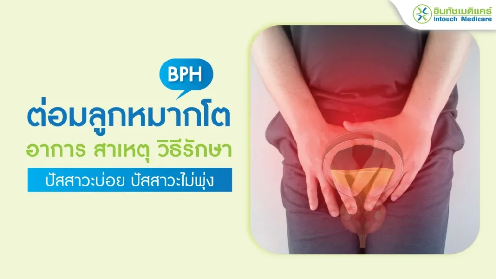 ต่อมลูกหมากโต