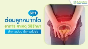 ต่อมลูกหมากโต