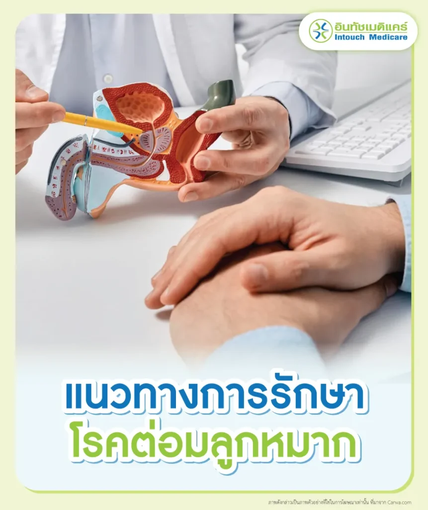 แนวทางการรักษาโรคต่อมลูกหมาก
