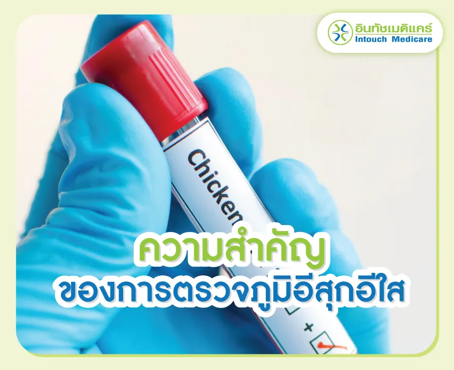 ความสำคัญของการตรวจภูมิอีสุกอีใส