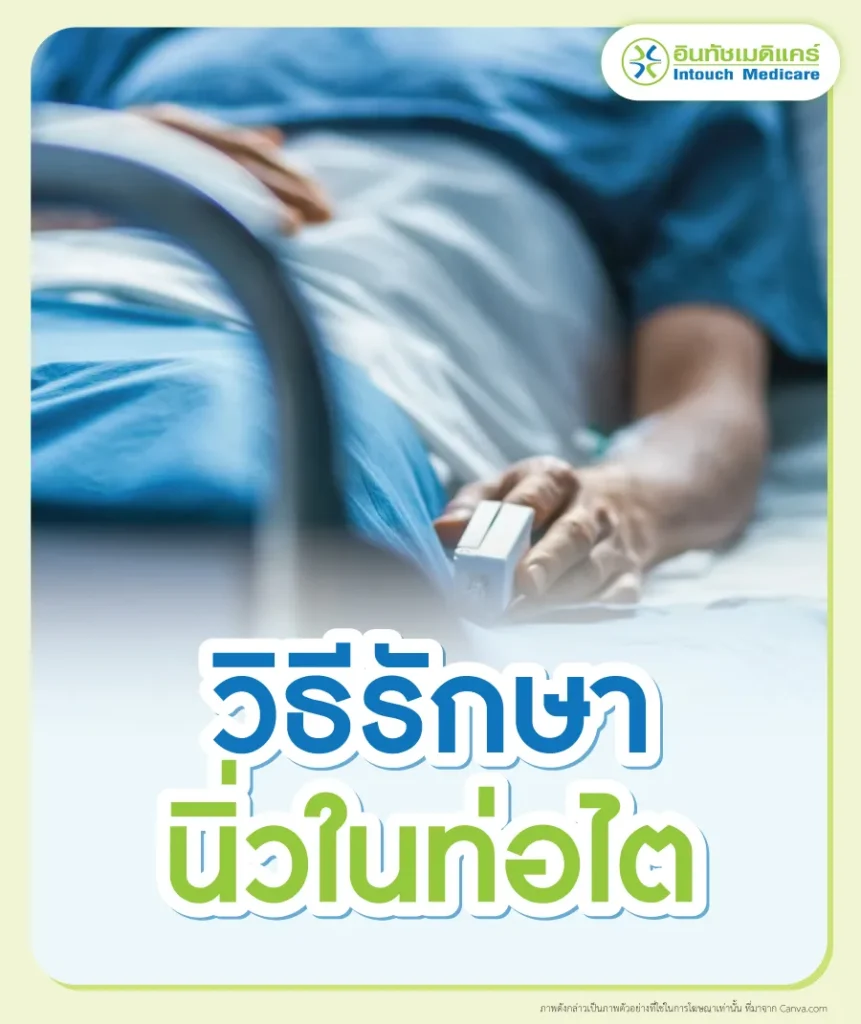 วิธีรักษานิ่วในท่อไต