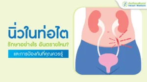 นิ่วในท่อไต