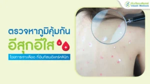 ตรวจภูมิคุ้มกันอีสุกอีใส