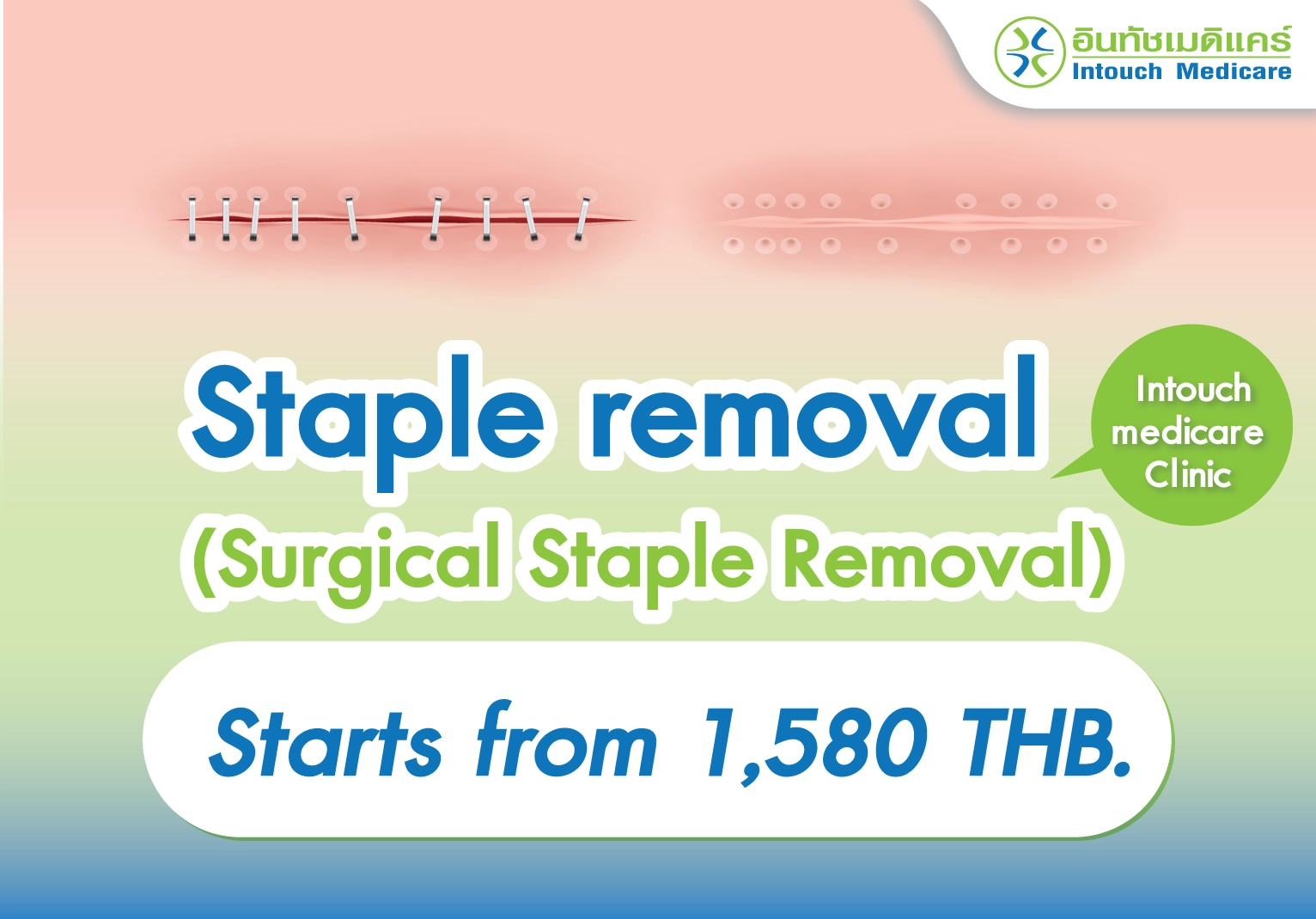How Much Does Staple Removal Cost