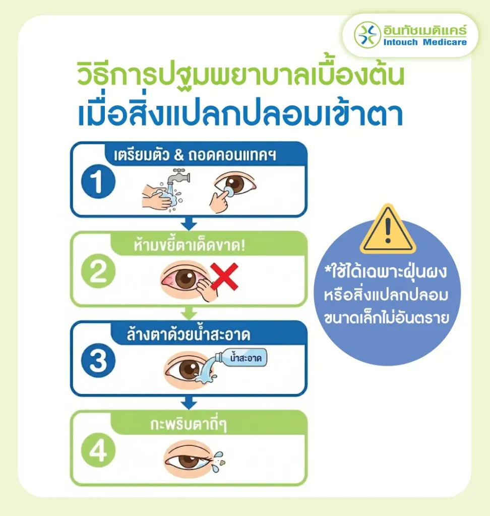 วิธีการปฐมพยาบาลเบื้องต้นเมื่อสิ่งแปลกปลอมเข้าตา 