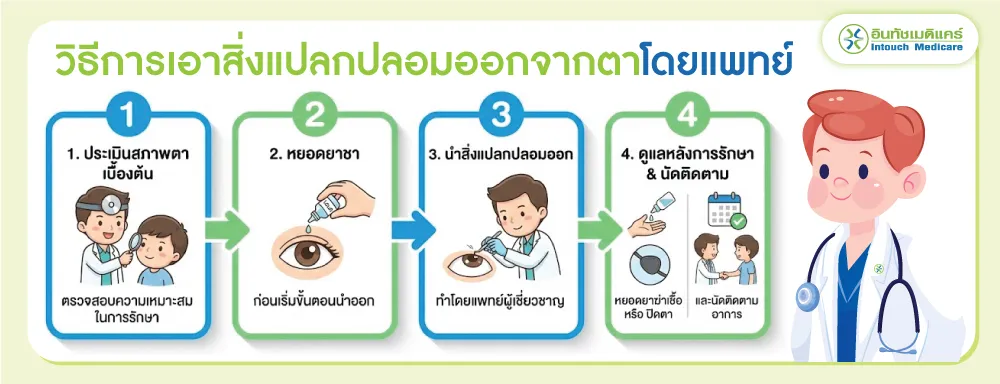 วิธีการเอาสิ่งแปลกปลอมออกจากตาโดยแพทย์