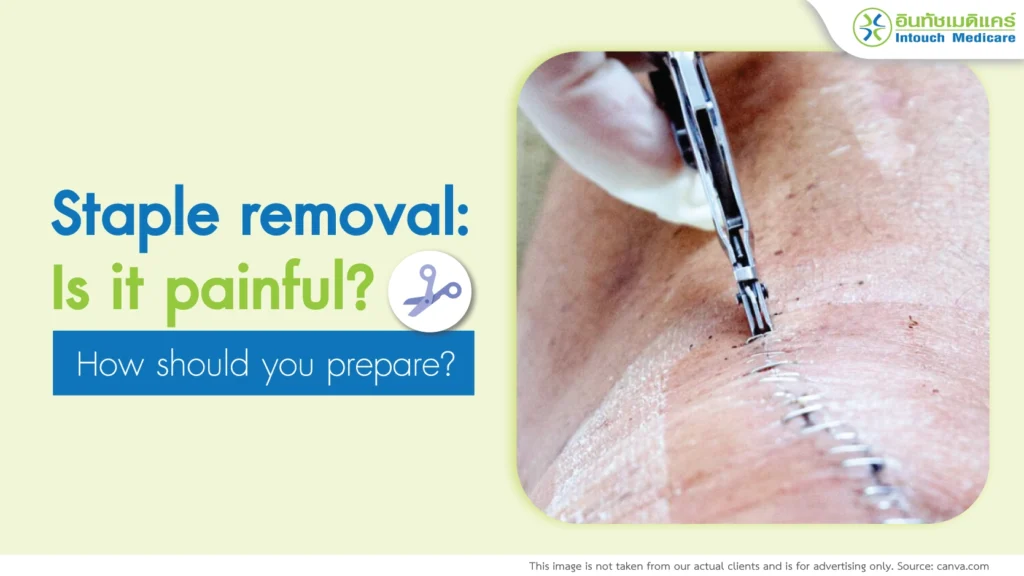 Staple removal