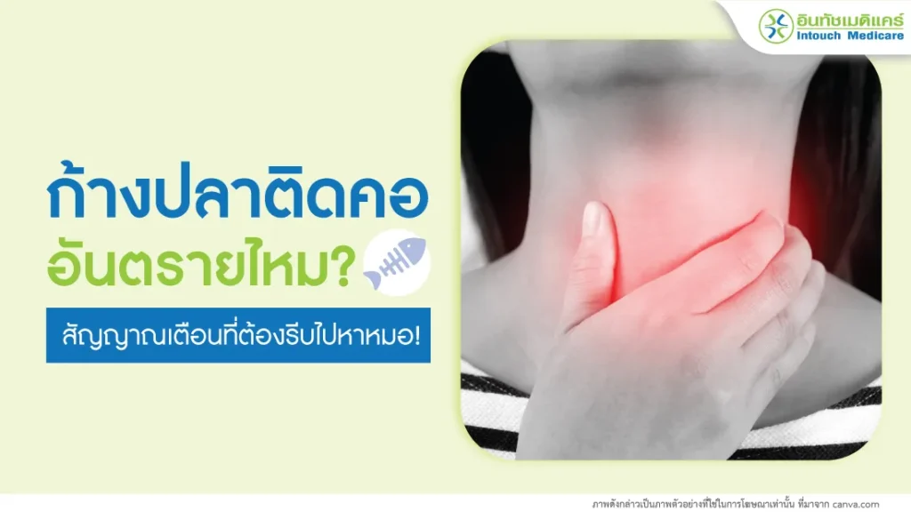 ก้างปลาติดคออันตรายไหม