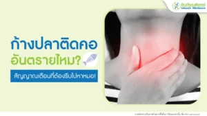 ก้างปลาติดคออันตรายไหม