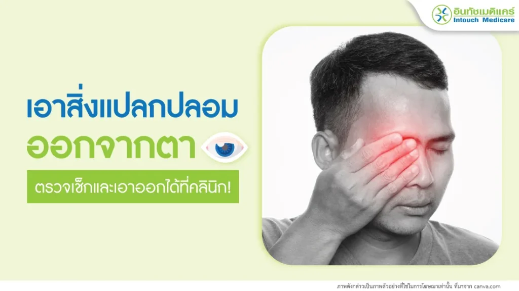 เอาสิ่งแปลกปลอมออกจากตา