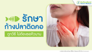 รักษาก้างปลาติดคอ