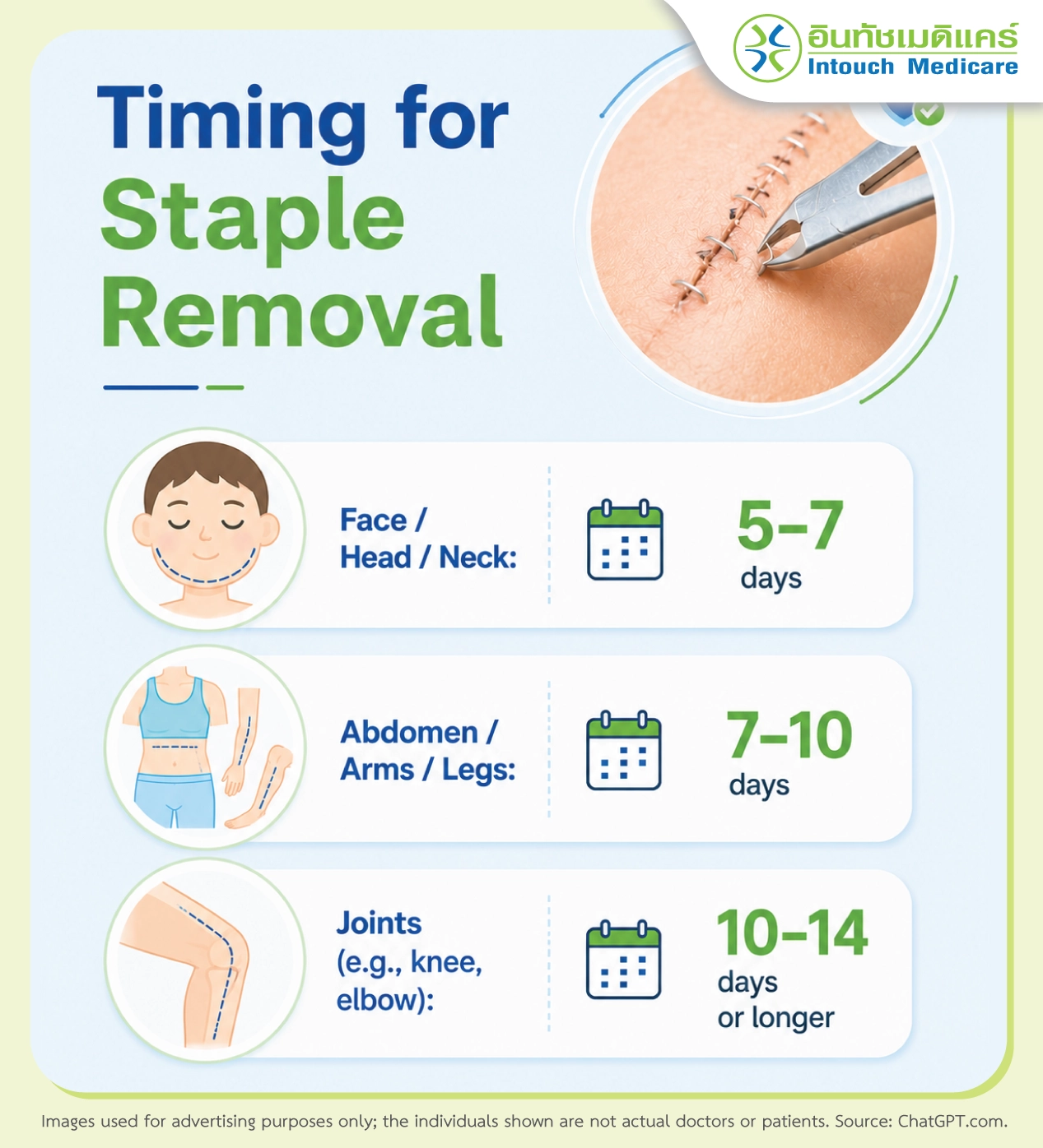 Timing for Staple Removal