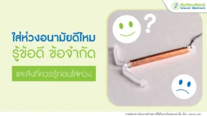 ใส่ห่วงอนามัยดีไหม รู้ข้อดี ข้อจำกัด และสิ่งที่ควรรู้ก่อนตัดสินใจ